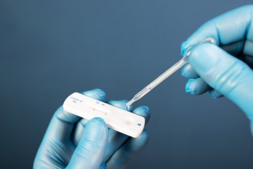Corona-Infektion – Berufungsverwerfung - genügende Entschuldigung - Foto vom Selbsttest